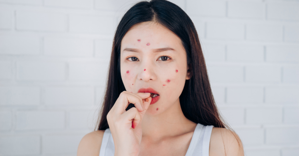 有人覺得吃A酸治皮膚百病,你覺得呢?(圖/canva)